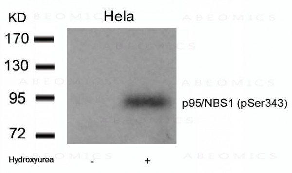 Anti-phospho-p95/NBS1 (Ser343)