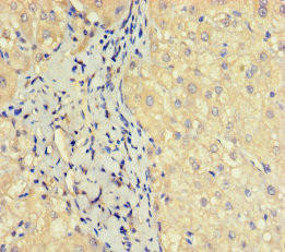 Anti-OBP2A