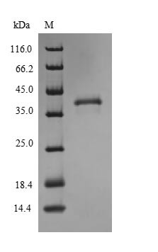 High affinity copper uptake protein 1 (SLC31A1) (Active), human, recombinant