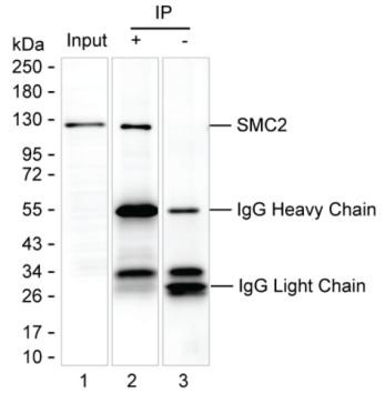 Anti-SMC2 (acetyl K114)