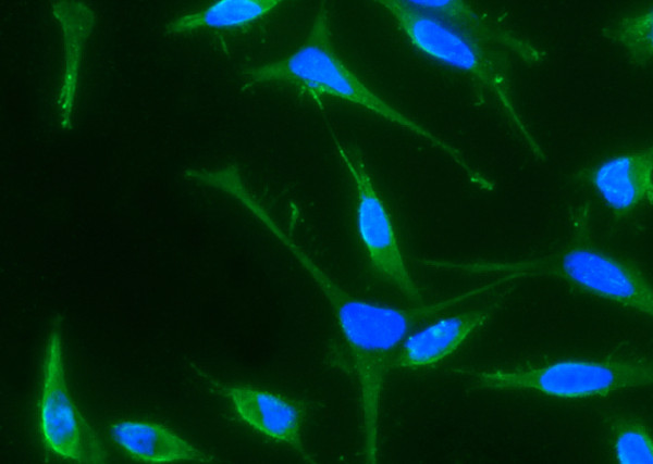 Anti-BMP-4 Monoclonal Antibody
