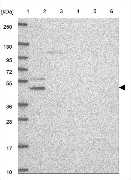 Anti-ZNF587B