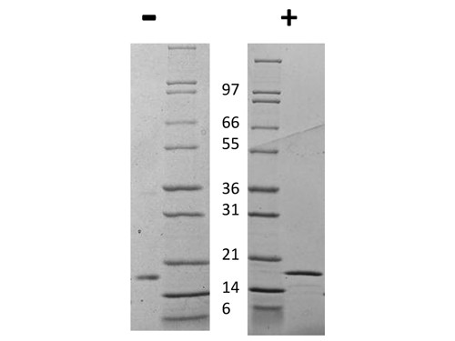 Interleukin-1 beta