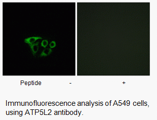 Anti-ATP5L2