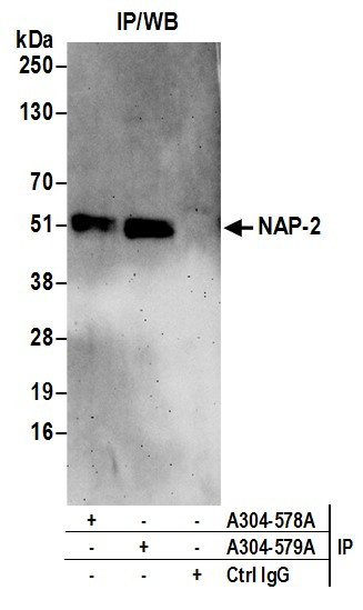 Anti-NAP-2