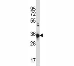 Anti-CCR10