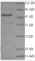 60S ribosomal protein L10a (RPL10A), partial, human, recombinant