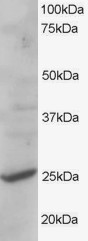 Anti-CYB561D2, C-terminal