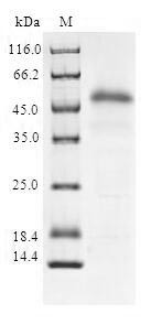 Suppressor of cytokine signaling 2 (SOCS2), human, recombinant