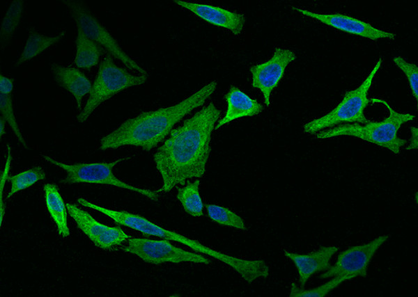 Anti-Vimentin Monoclonal Recombinant Antibody
