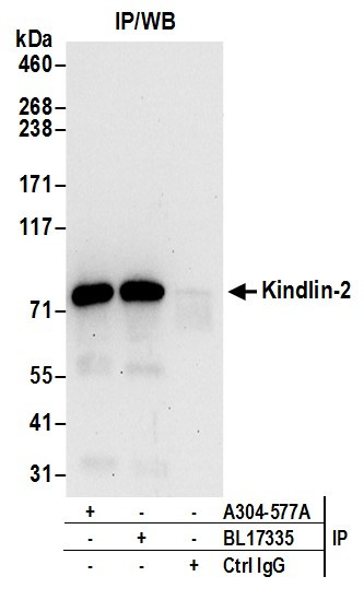 Anti-Kindlin-2