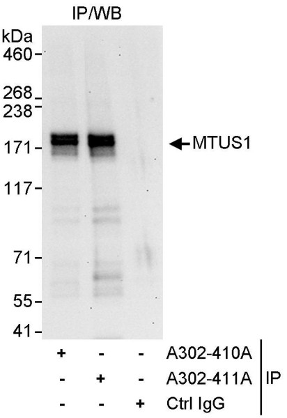 Anti-MTUS1