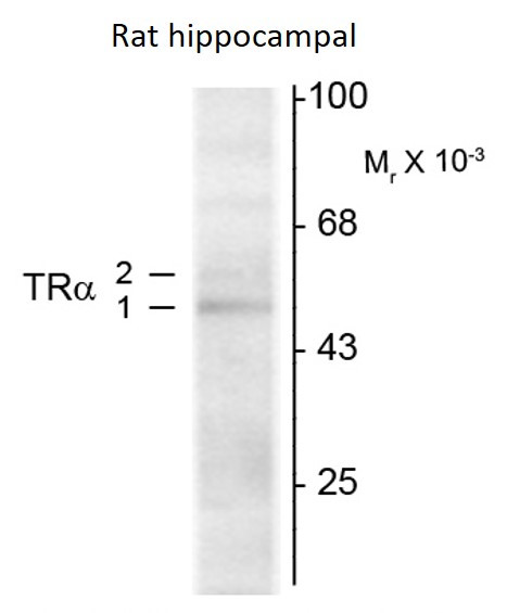Anti-Thyroid Hormone Receptor alpha, clone 1718