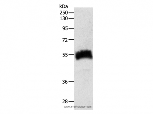 Anti-SLC22A6