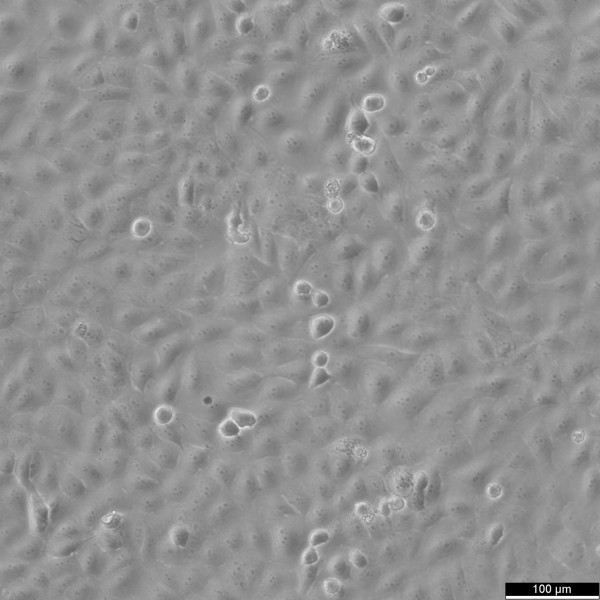 OVCAR-8 Cells