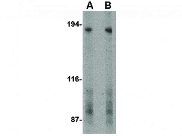 Anti-TEM5