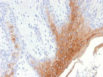 Anti-Cytokeratin 10 (KRT10) (Suprabasal Epithelial Marker) Recombinant Rabbit Monoclonal Antibody (c