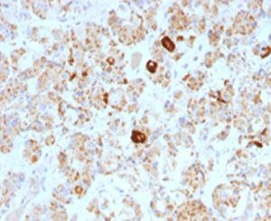 Anti-Luteinizing Hormone beta, clone SPM103