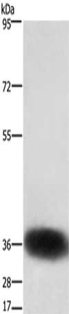 Anti-SLC7A5
