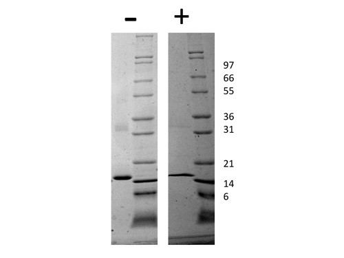 Tumor Necrosis Factor alpha