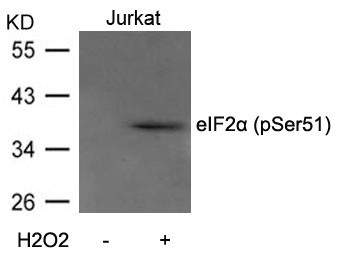 Anti-phospho-eIF2 alpha (Ser51)