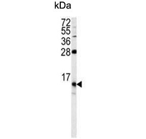 Anti-FKBP1B