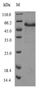 Tumor necrosis factor receptor superfamily member 5 (CD40), partial (Active), human, recombinant