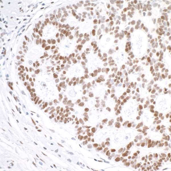 Anti-gamma-H2AX Recombinant Monoclonal