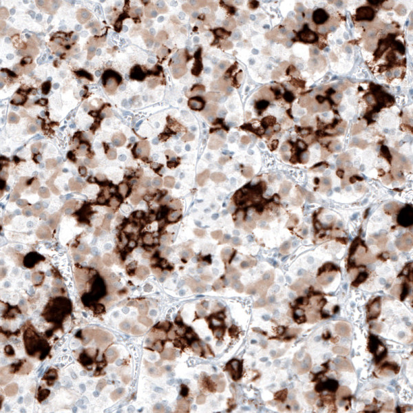 Anti-PRL, clone CL6559