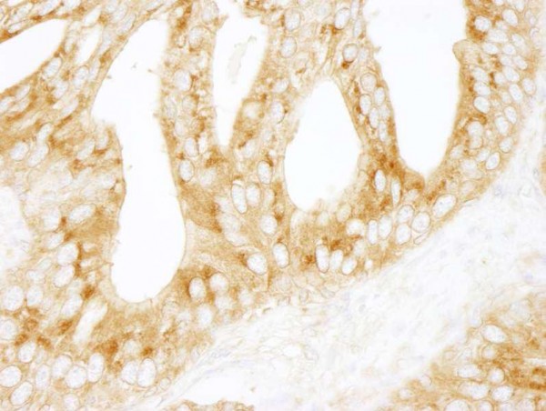 Anti-PRKAR2A/PKA-RIIalpha (IHC)
