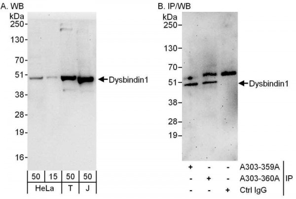 Anti-Dysbindin1