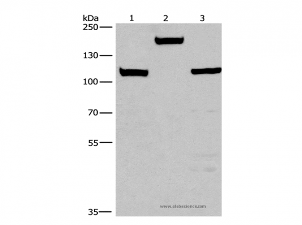 Anti-TP53BP2