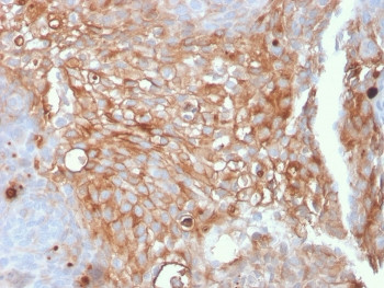 Anti-Uroplakin 1A / UPK1A, clone UPK1A/2925