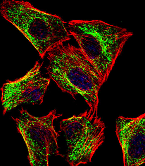 Anti-ATP5J