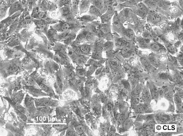 SK-MES-1 Cells