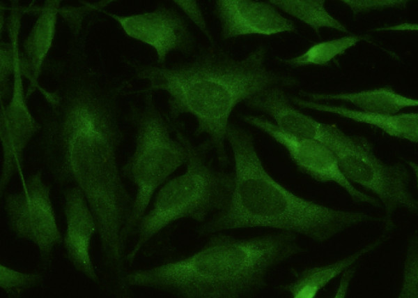 Anti-BACE1 Monoclonal Recombinant Antibody