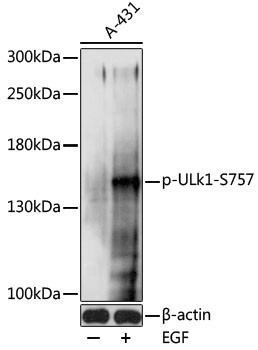 Anti-phospho-ULk1 (Ser757)
