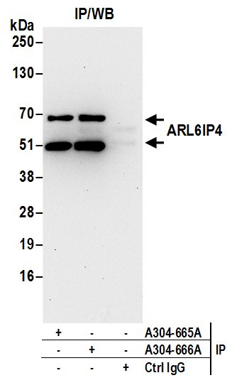 Anti-ARL6IP4