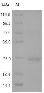 Histone deacetylase HDT2 (HDT2), Arabidopsis thaliana, recombinant