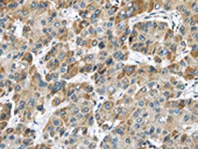 Anti-CHRNA1