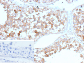Anti-SV2A / Synaptic vesicle glycoprotein 2A, clone r15E11