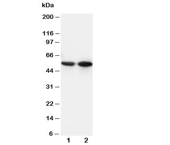 Anti-CD14