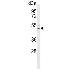 Anti-S1PR4 / EDG6