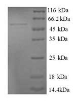 39S ribosomal protein L9, mitochondrial (MRPL9), human, recombinant