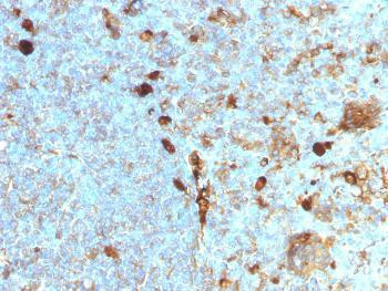 Anti-Alpha-1-Antitrypsin (SERPINA1) (Hepatocellular &amp; Histiocytic Marker) Monoclonal Antibody (Clone