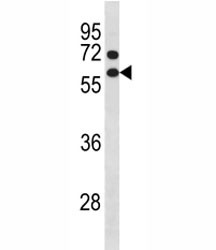 Anti-Cyclin B1 (CCNB1)