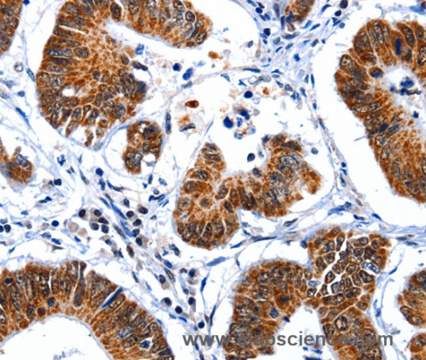 Anti-GSK3A