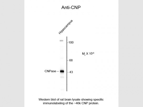 Anti-CNP (2,3-cyclic nucleotide-3-phosphodiesterase)