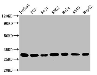 Anti-GSTO1 Recombinant Monoclonal, clone 2C7