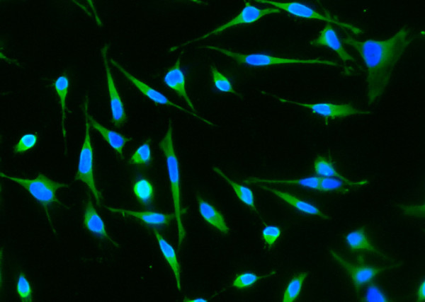 Anti-RhoA Monoclonal Antibody